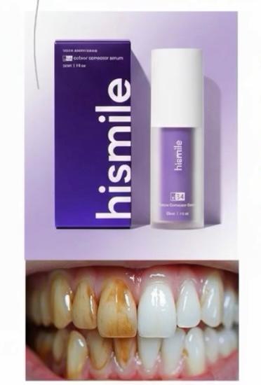 HISMILE V34 - Dentifrice blanchissante