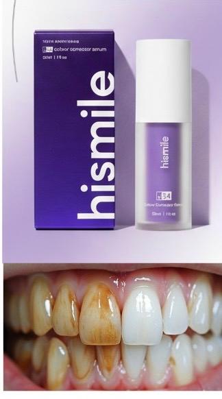 HISMILE V34 - Dentifrice blanchissante